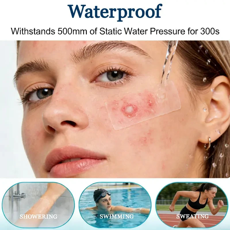 Custom Cut Hydrocolloid Patch Roll